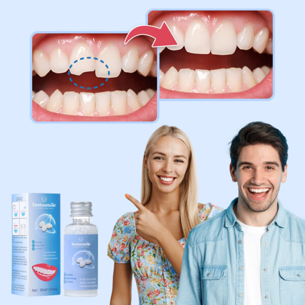 INSTASMILE KIT DE REPARARE A DINȚILOR